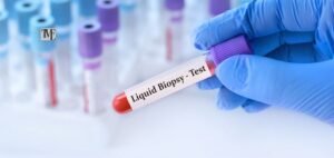 Read more about the article Unlocking Pathways: Advancing Cancer Care Through Liquid Biopsy Technologies